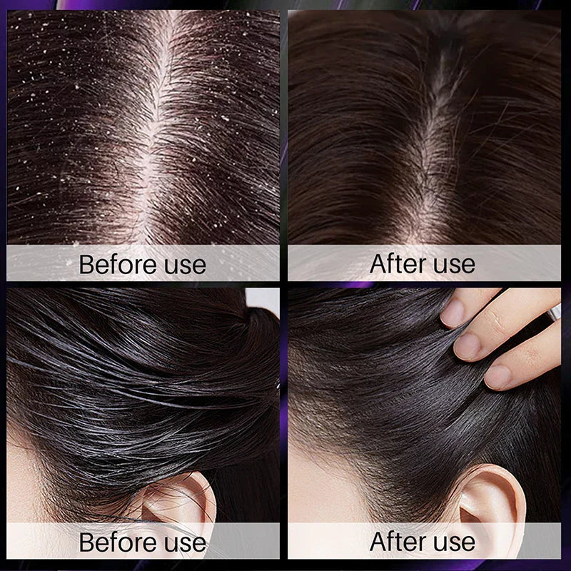 Hair Growth Thickening Shampoo with Rosemary Onion